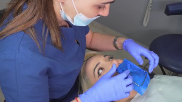 歯のパンチとコファダムスカーフで手袋の歯科医の手 歯医者はゴムダムで患者に女性の歯を扱います 近代的な歯科事務所 介護の排除 充填の設置 — ストック動画
