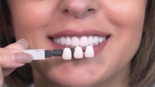 Conceito Branqueamento Cuidados Dentários Implantes Para Folheados Mulher Branca Idosa — Vídeo de Stock