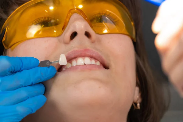 Kız hasta ve takma diş, gölge seçimi. Diş hekimi özel ölçekte diş rengi seçiyor. Dişçi koltuğunda oturan genç bir kadın. Protodontikler. Beyazlama .