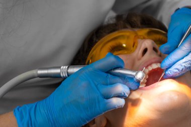 Kadın dişçi ve asistan diş kalkülüsünü dişlerinden çıkarıyor. Ziyaret, profosyonel diş kliniğinde. Kadın dişçi koltuğunda oturuyor. Diş delme ve işleme, dolgu.