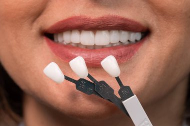 Beyazlatma konsepti. Diş bakımı, kaplamalar için implantlar. Mükemmel gülüşü olan güzel beyaz kadın diş sağlığı kliniğinde diş rengini seçiyor. Modern tıp.