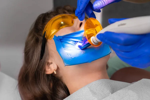 Dentysta Wypełnia Ząb Pacjenta Kompozycją Wypełnienia Asystent Świeci Lampą Ultrafioletową — Zdjęcie stockowe