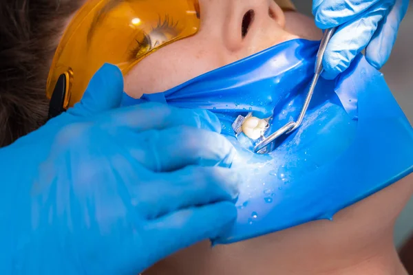 Diş Kliniğinde Mavi Fındıklı Bir Hasta Lateks Eldivenli Bir Dişçi — Stok fotoğraf
