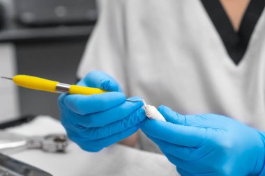 Dişçinin elinin yakın çekimi özel bir enstrümanın dolgu malzemesini alıyor. Diş hekimliğinde kullanılan bileşik dolgu malzemesi.