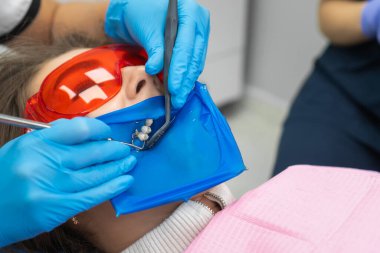 Diş hekimi, hastasının dişlerini fındık kabuğu ile muayene eder. Tıbbi aletlerle dişçi elleri. Sağlıklı diş kavramı