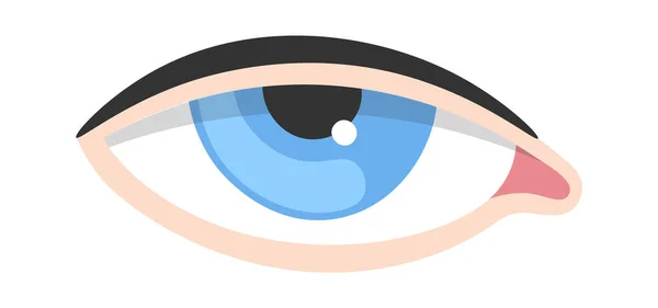Ptosis Human Eye Disease Vector Illustration — Stockvektor