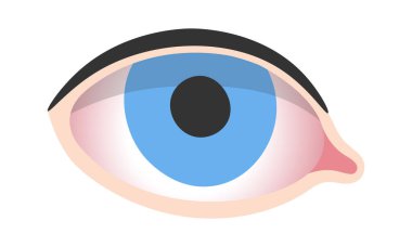 Kuru Göz Hastalığı Vektörü İllüstrasyonu