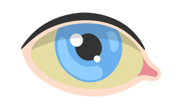 Gelbsucht Human Eye Disease Vector Illustration — Stockvektor
