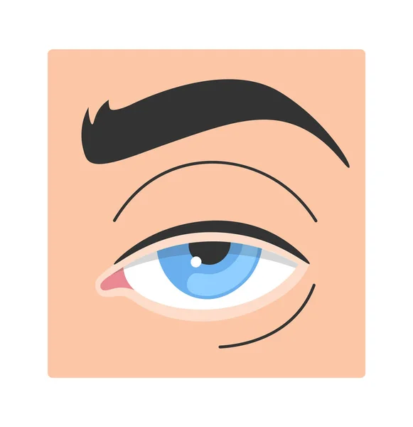 Illustration Vectorielle Des Maladies Oculaires Humaines — Image vectorielle