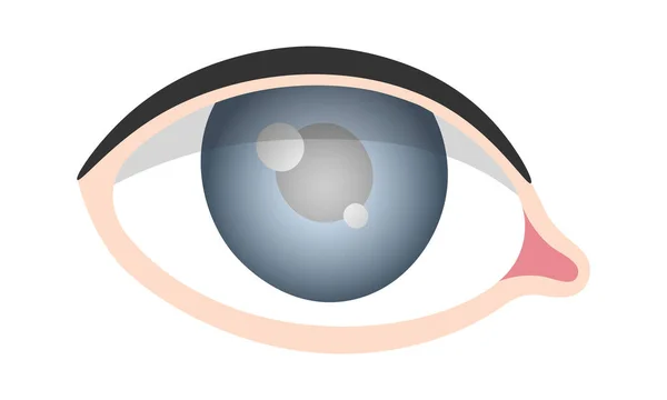 Glaucoma Enfermedad Ocular Vector Ilustración — Vector de stock