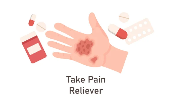 Tratamento Das Lesões Mão Com Ilustração Vetor Alivio Dor — Vetor de Stock