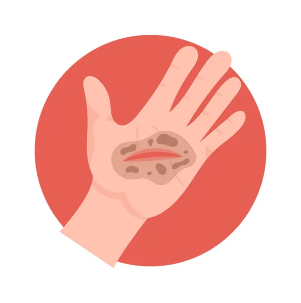Dirt Wound Hand Vector Illustration — Stock Vector