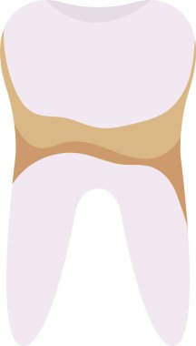 Plaket Diş Problemi Vektörü İllüstrasyonu