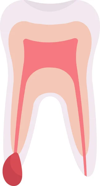 Kist Diş Problemi Vektörü Llüstrasyonu — Stok Vektör