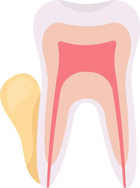 Flux Tooth Problem Vector Illustration — Stock Vector