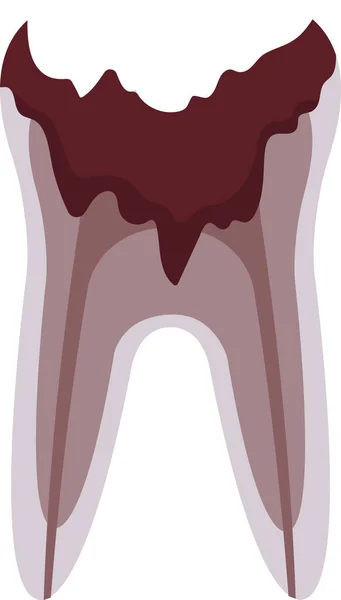 Illustrazione Vettoriale Del Problema Del Dente Morto — Vettoriale Stock