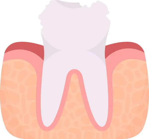 Illustrazione Vettoriale Del Problema Dei Denti Decaduto — Vettoriale Stock