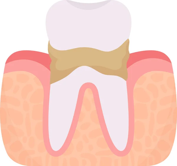 カルカス歯の問題ベクターイラスト — ストックベクタ