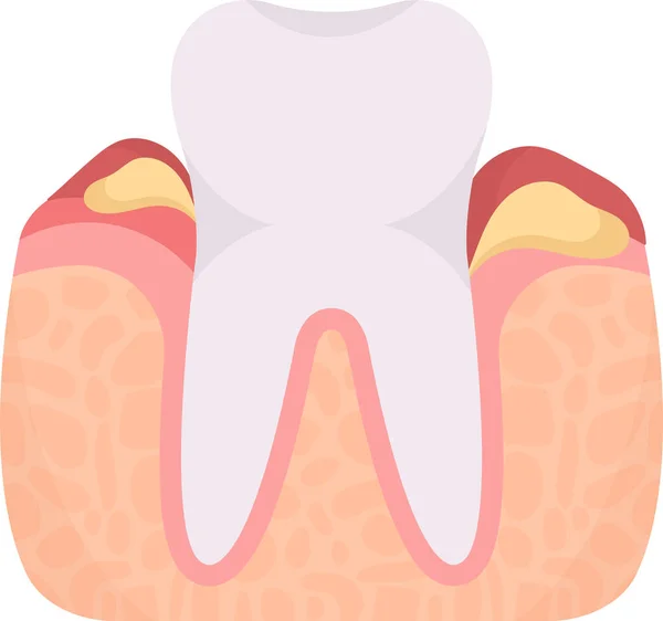 Flusso Dentale Dente Problema Vettoriale Illustrazione — Vettoriale Stock