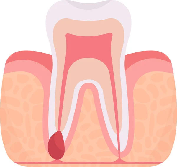 シス歯の問題ベクターイラスト — ストックベクタ