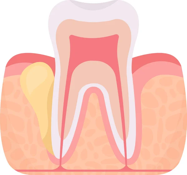 フラックス歯の問題ベクターイラスト — ストックベクタ
