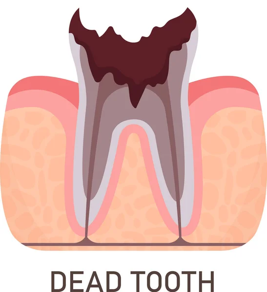 Dead Tooth Problem Vector Illustration — Stock Vector