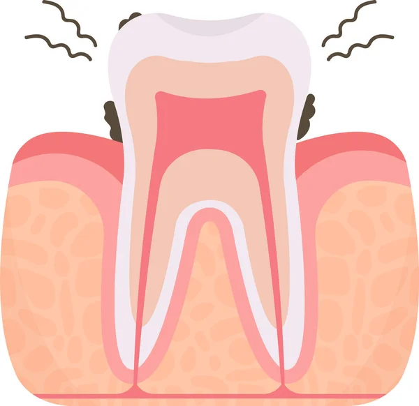 Bad Breath Tooth Problem Vector Illustration — Stock Vector