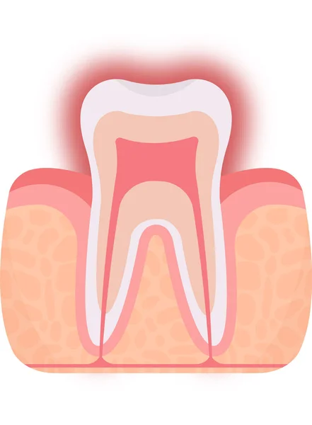 Sensitive Tooth Problem Vector Illustration — Stock Vector