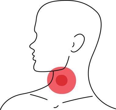 Gırtlak Çizgisindeki İnsan Ağrısı Vektör İllüstrasyonu