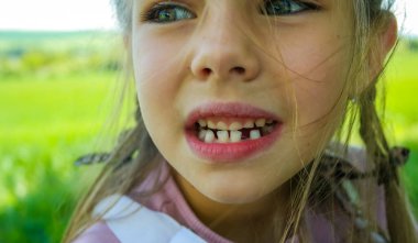 Sevimli bir kızın gülümsemesi. Üç diş döküldü, azı dişleri için çok az yer var. Süt dişleri dökülüyor. Yakın plan. Bir ortodontist tarafından muayene. Yüksek kalite fotoğraf