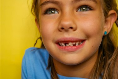 Dişleri dökülmüş, mavi tişörtlü, sarı arka planda gülümseyen genç bir kız. Kahverengi saçlı ve mavi gözlü. Bebek dişleri kalıcı dişlerle değiştiriliyor. Yüksek kalite fotoğraf
