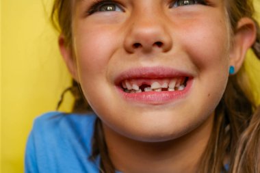 Dişleri dökülmüş, mavi tişörtlü, sarı arka planda gülümseyen genç bir kız. Kahverengi saçlı ve mavi gözlü. Bebek dişleri kalıcı dişlerle değiştiriliyor. Yüksek kalite fotoğraf