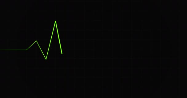 Heartbeat Display Monitor Motion Graphics Electro Cardiogram Heart Beat Cardiogram — Stok video