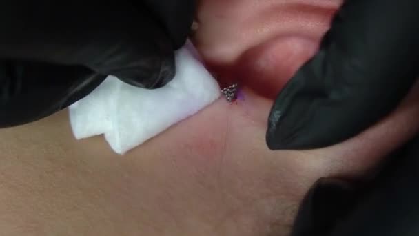 Zbliżenie Dłoni Czarnych Rękawiczkach Medycznych Wyciera Miejsce Nakłucia Uchu Wacikiem — Wideo stockowe