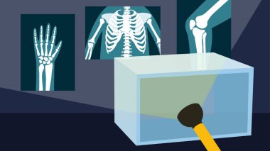 viewing x-rays of a person clipart