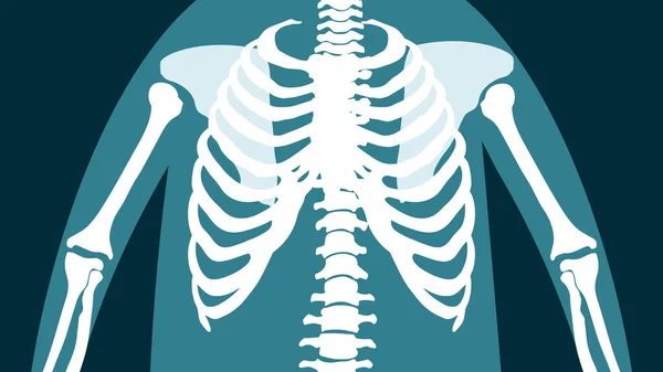 Radiografía Del Pecho Humano — Foto de Stock