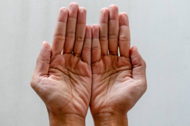 Bir adamın kırışık parmakları uzun zamandır suda ıslandığı için buruşmuş.