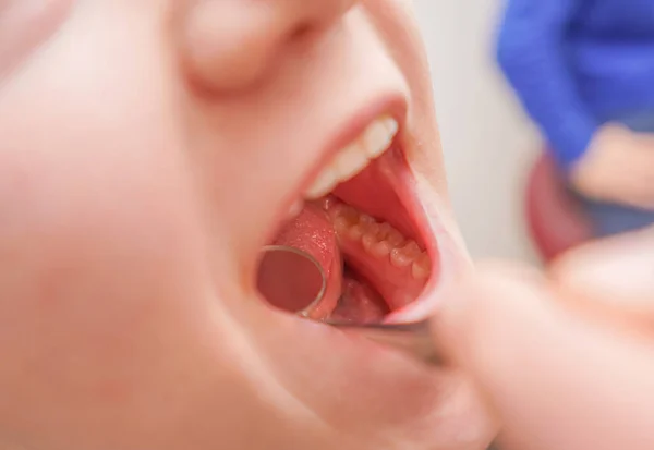Dentist Examines Teeth Mouth Girl — 图库照片