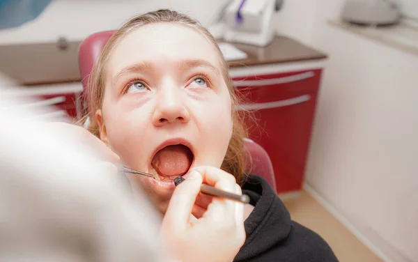 Ung Flicka Kollar Tand Tandläkares Tid — Stockfoto