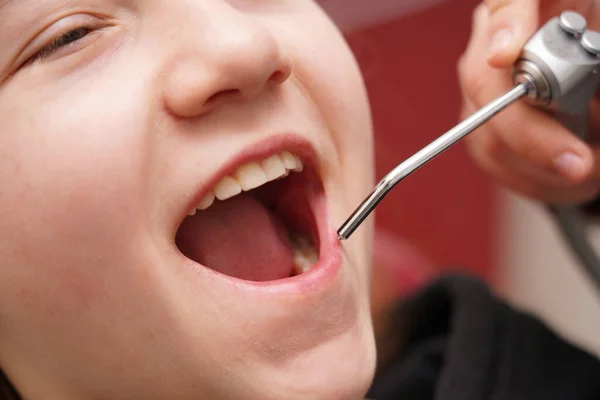 Kız Dişçi Koltuğunda Oturuyor Doktor Kızın Ağzında Çeşitli Manipülasyonlar Yapıyor — Stok fotoğraf