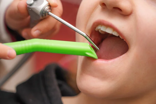 Flicka Hos Tandläkaren Läkaren Kontrollerar Och Undersöker Barnets Tänder — Stockfoto