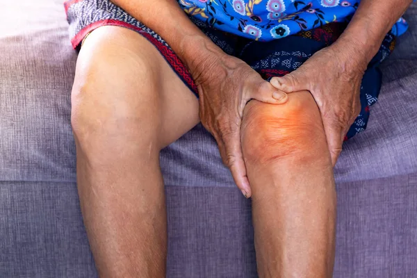 Senior woman holding the knee with pain on sofa in living room at home. Old age. she is having symptoms Pain on both sides of the knee, due to osteoporosis, to retirement age and health care concept.