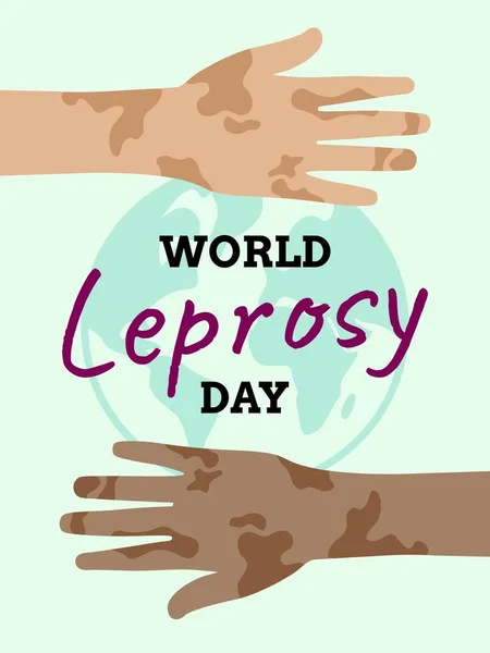 Cartel Del Día Mundial Lepra Evento Internacional Salud Enero — Vector de stock