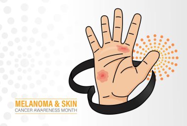 Mayıs 'ta Melanoma ve Cilt Kanseri Farkındalığı Ay Tasarımı. Siyah Gerçekçi Farkındalık Kurdelesi