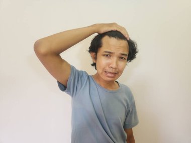 Asyalı bir adamın kel kalıp saçlarının döküldüğünü görünce şok oldum.