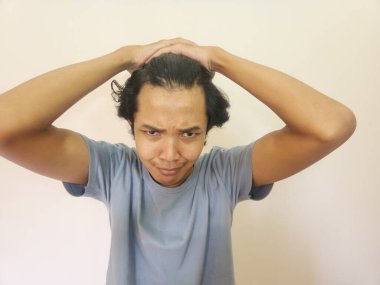 Asyalı bir adamın kel kalıp saçlarının döküldüğünü görünce şok oldum.