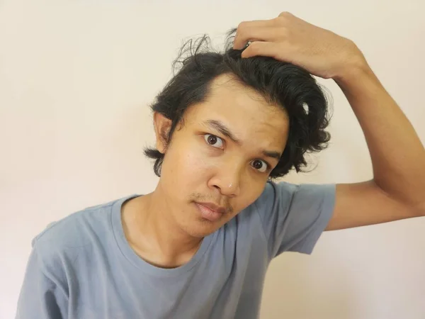 Chockad Ansikte Asiatisk Man Att Bli Skallig Och Förlorat Hår — Stockfoto