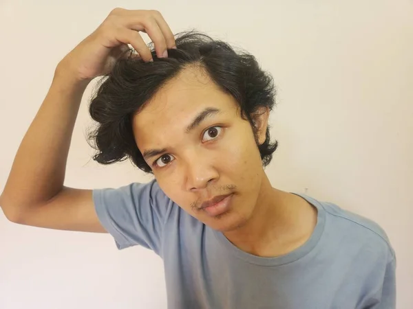 Choqué Visage Homme Asiatique Devient Chauve Perdu Les Cheveux Dans — Photo