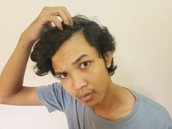 Šokovaný Obličej Asijského Muže Stále Plešaté Ztracené Vlasy Izolované Bílé — Stock fotografie