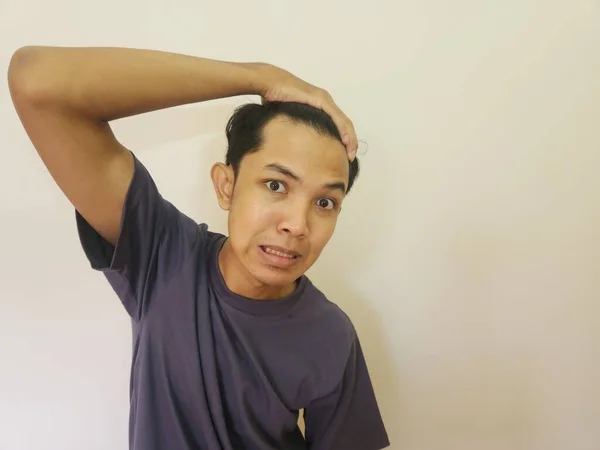 Вражене Обличчя Азіатського Чоловіка Лисіє Втрачає Волосся Ізольованому Білому Фоні — стокове фото